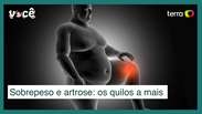Sobrepeso e artrose: cada quilo adicional aumenta 4 kg sobre os joelhos